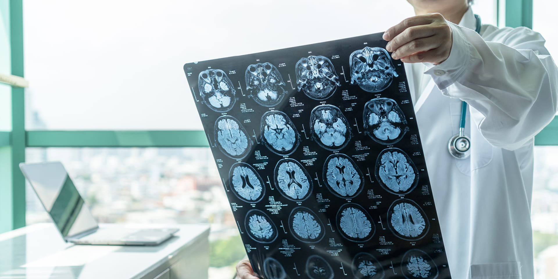 Doctor holding brain scans