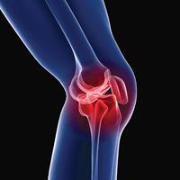 X-Ray view of a knew | Doylestown Health